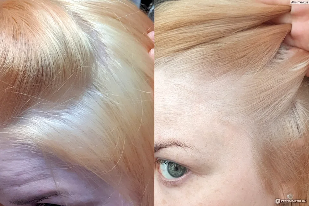 8.37 On hair