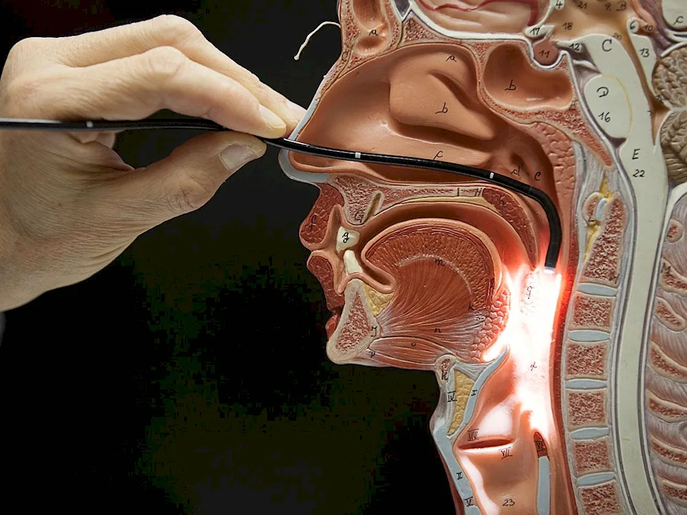 Adenoids and eustachian tube