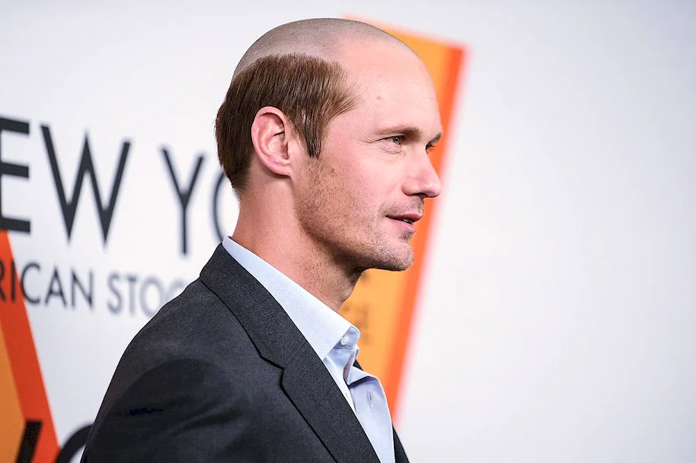Receding Hairline