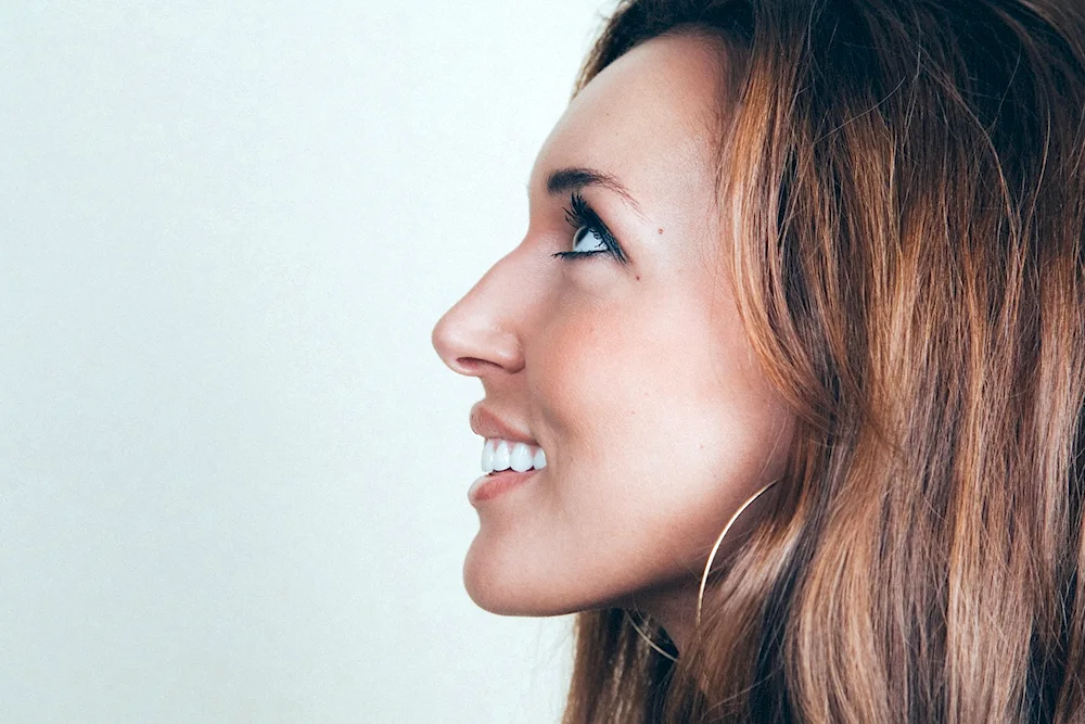 Kate Middleton rhinoplasty