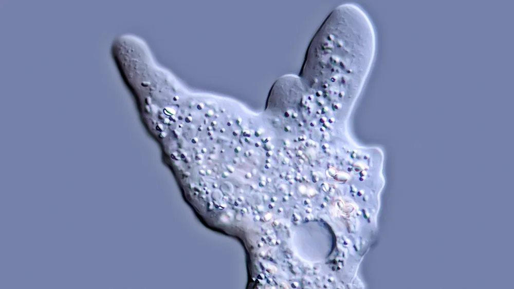 Amoeba