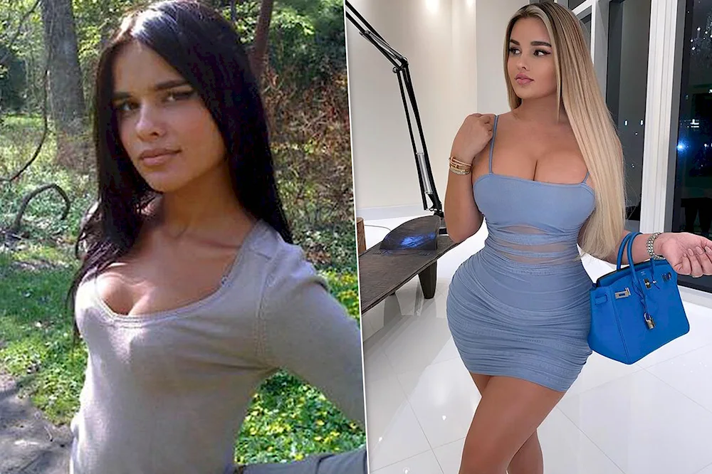 Anastasia Kvitko before plastic surgery as a young girl.