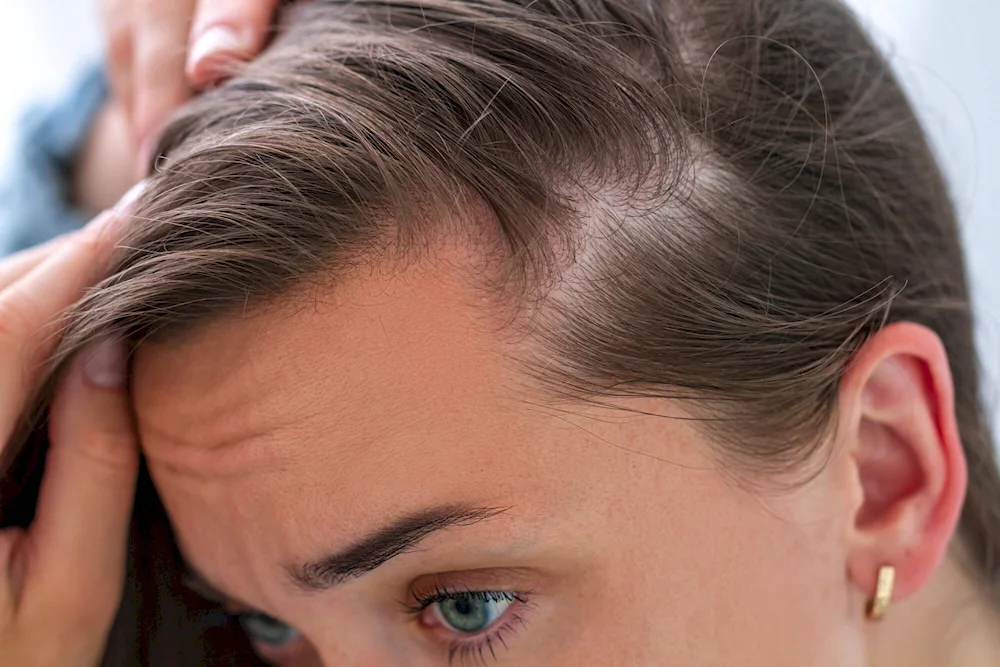 Healthy scalp parting on long hair