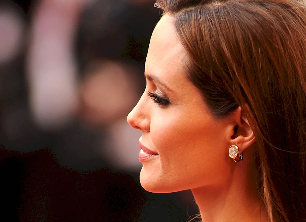 Humpy nose rhinoplasty