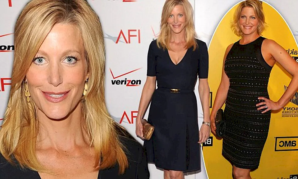 Anna Gunn