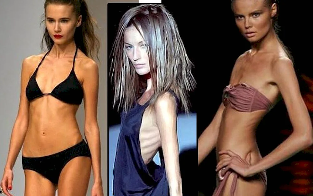 Anna Reston the skinniest model