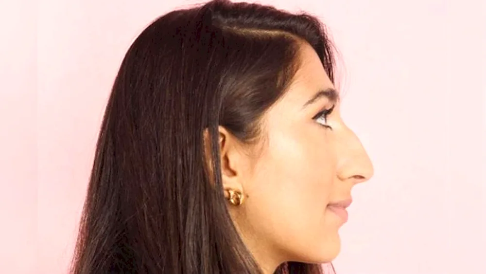 Armenian nose in profile