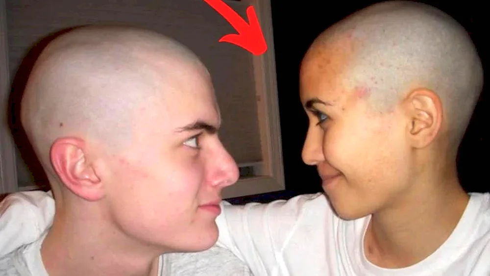 Andrey Afanasiev trichopigmentation