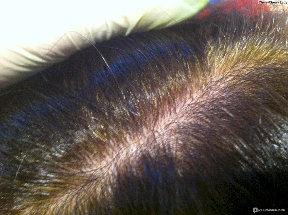 HaNa for Hair.