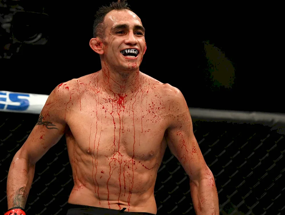 MMA fighter Tony Ferguson