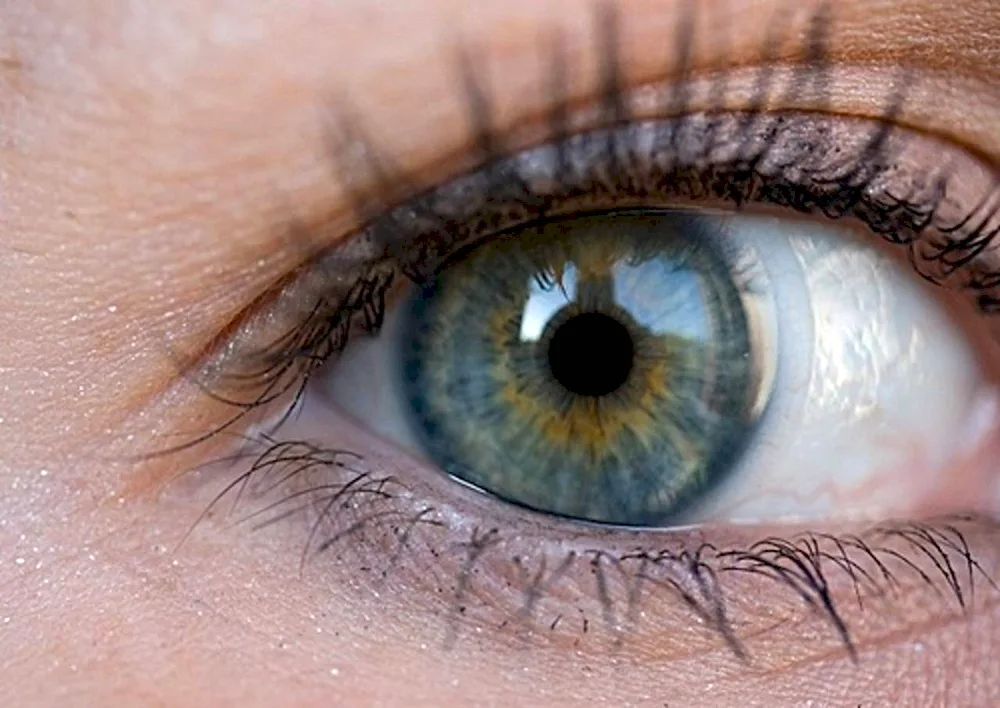 Boggy heterochromia eye colour