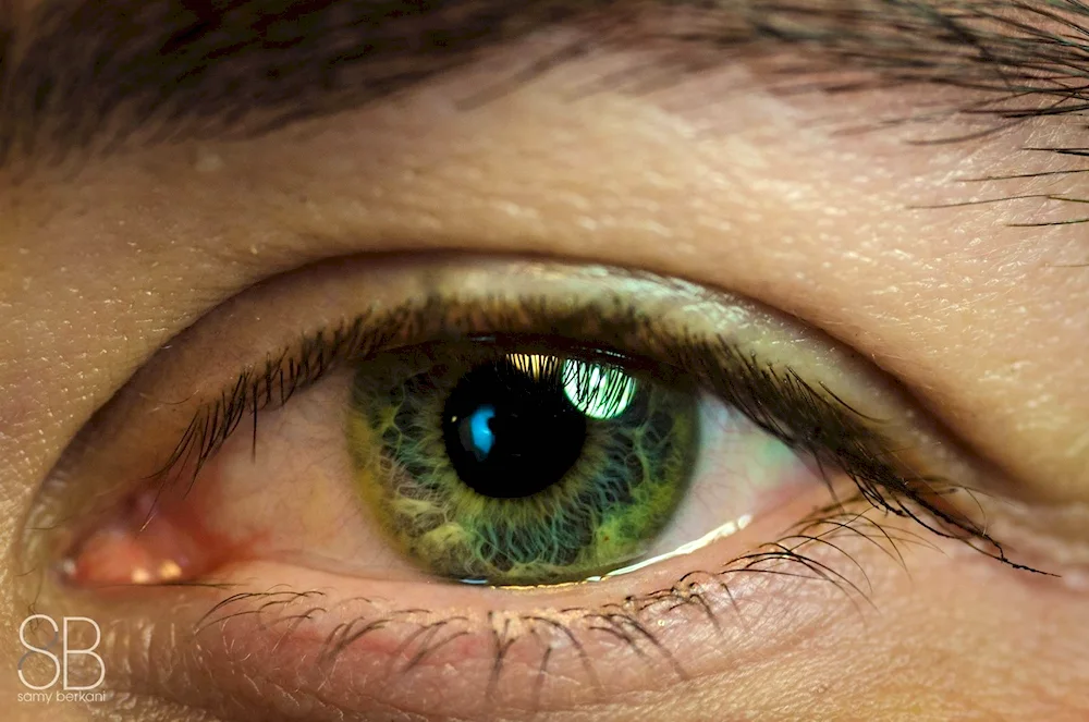 Beautiful eye colour heterochromia