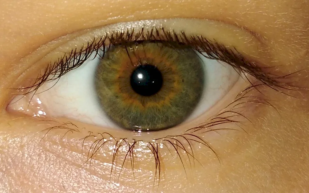 Boggy heterochromia eye colour