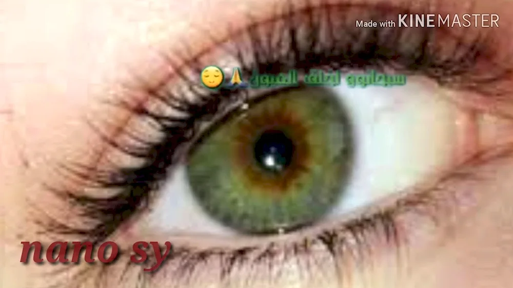 Boggy heterochromia eye colour