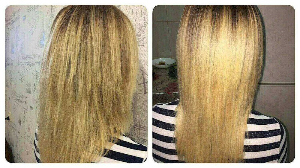 Botox for melinated hair