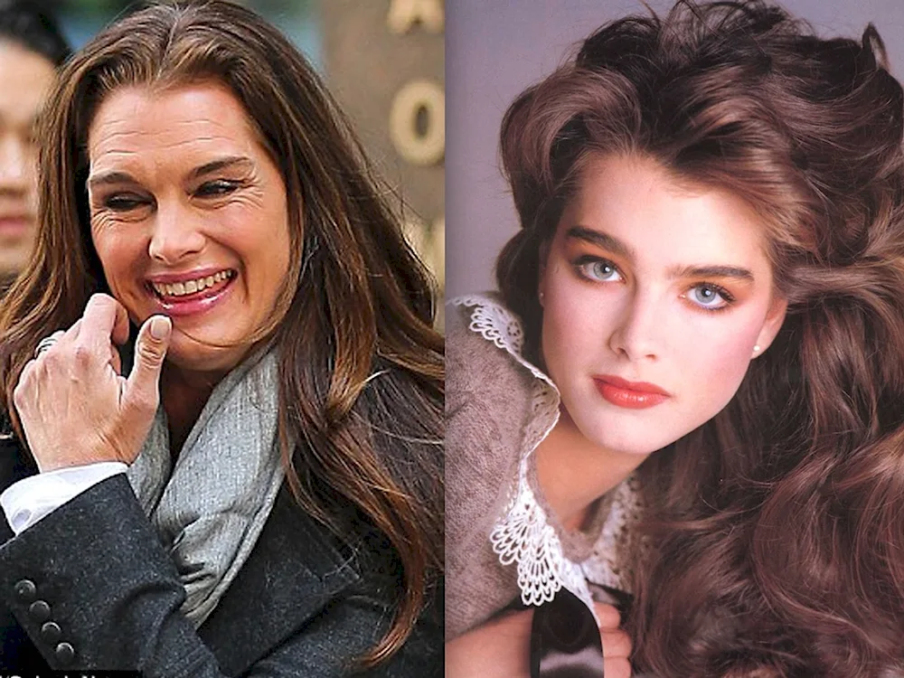 Brooke Shields