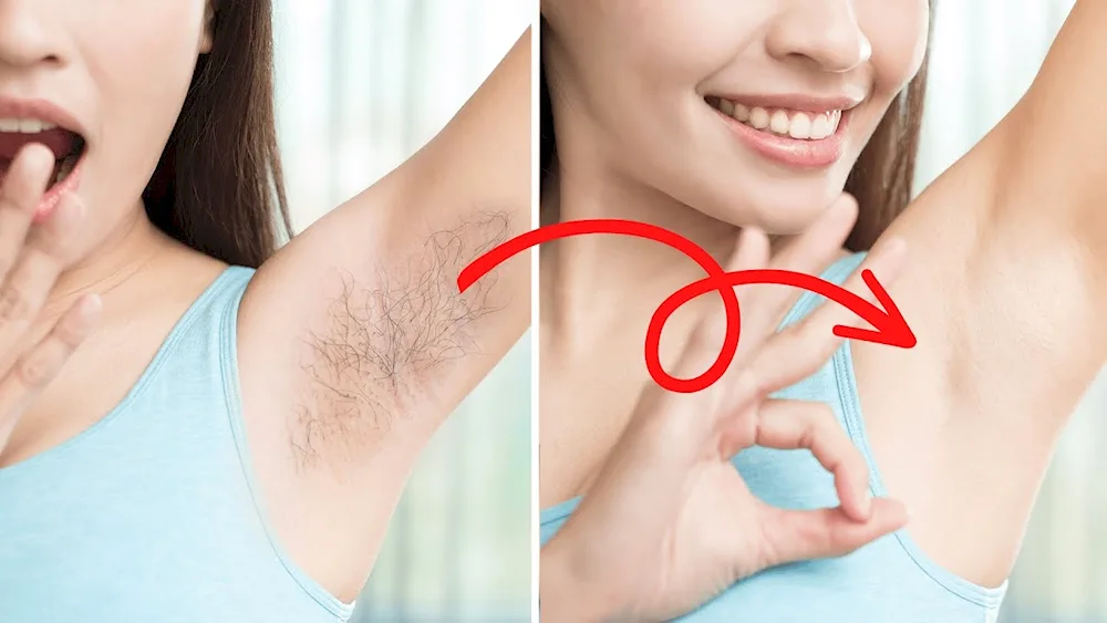 Acanthosis on the armpits