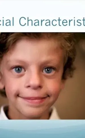 Children elves Williams syndrome