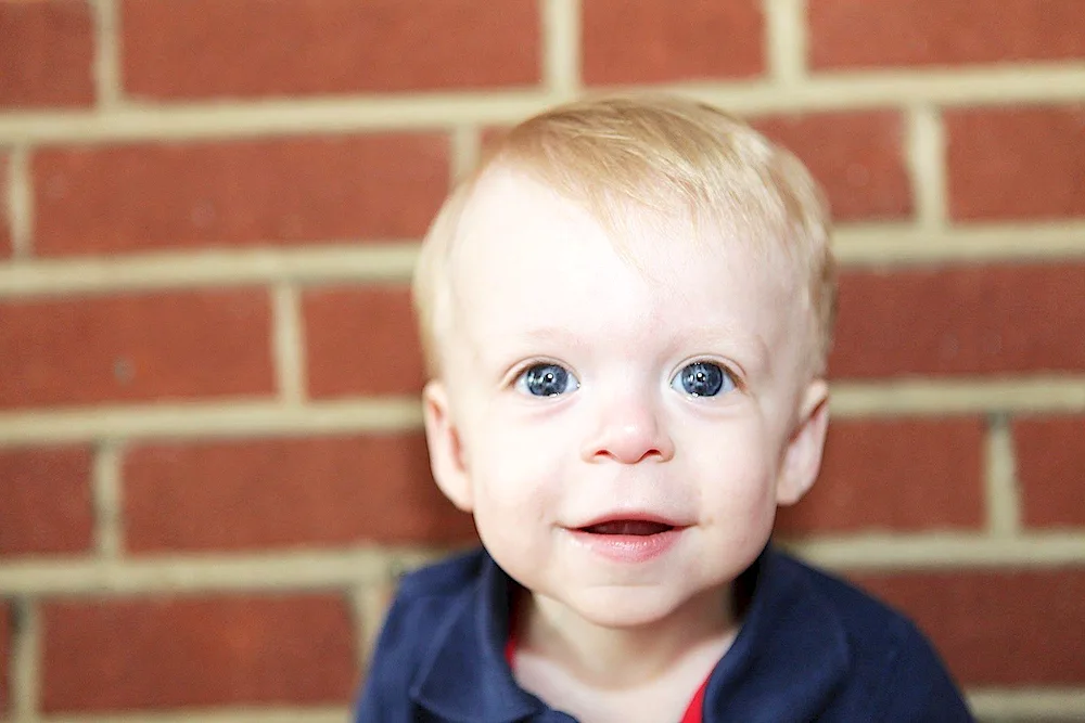 Children elves Williams syndrome