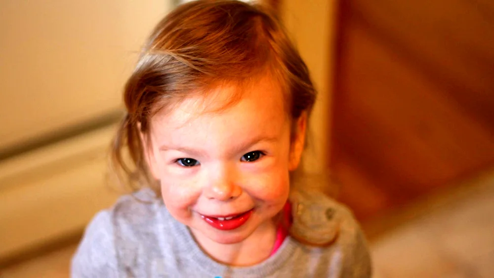 Children elves Williams syndrome