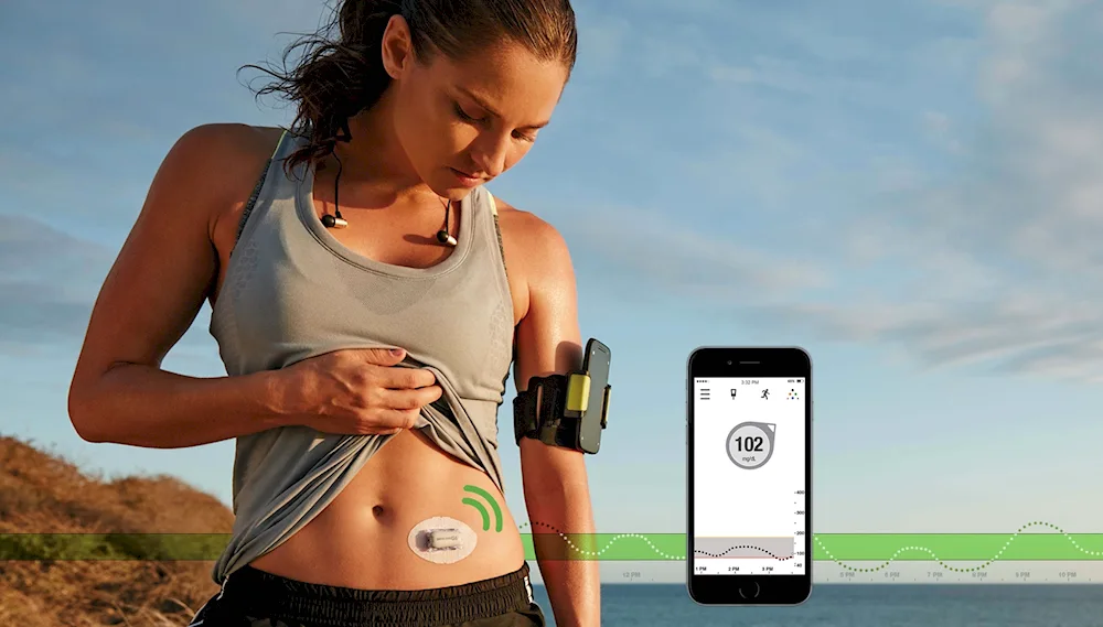 Dexcom g1