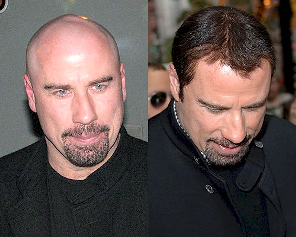 Natasha Whiteman bald