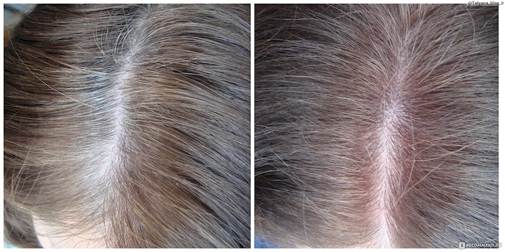 Gamma toning grey hair