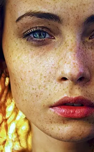 Emma Stone freckles