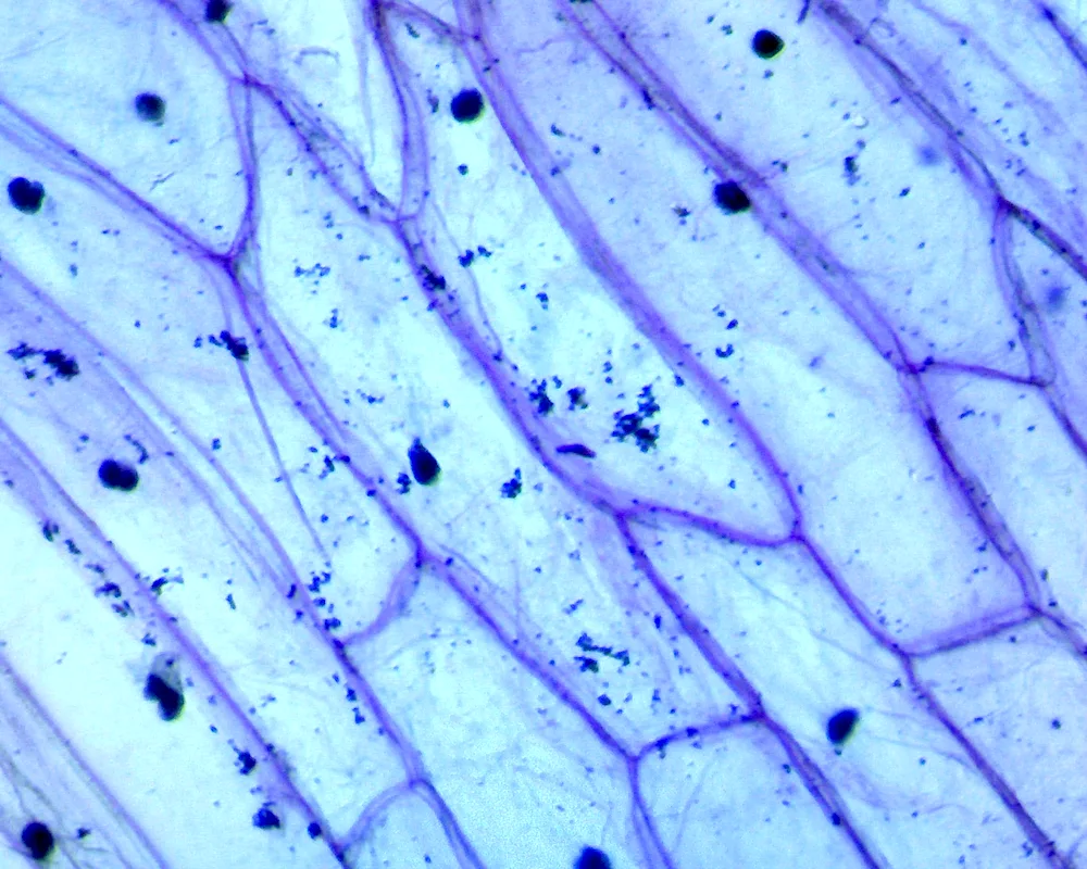 Lamellar emulsion under the microscope