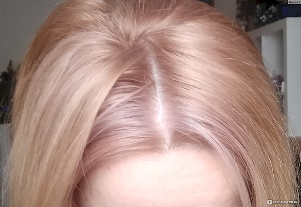 Matrix Rose Gold