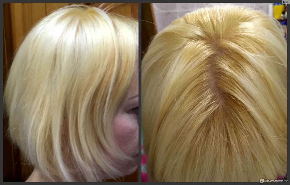 Tonics after bleaching