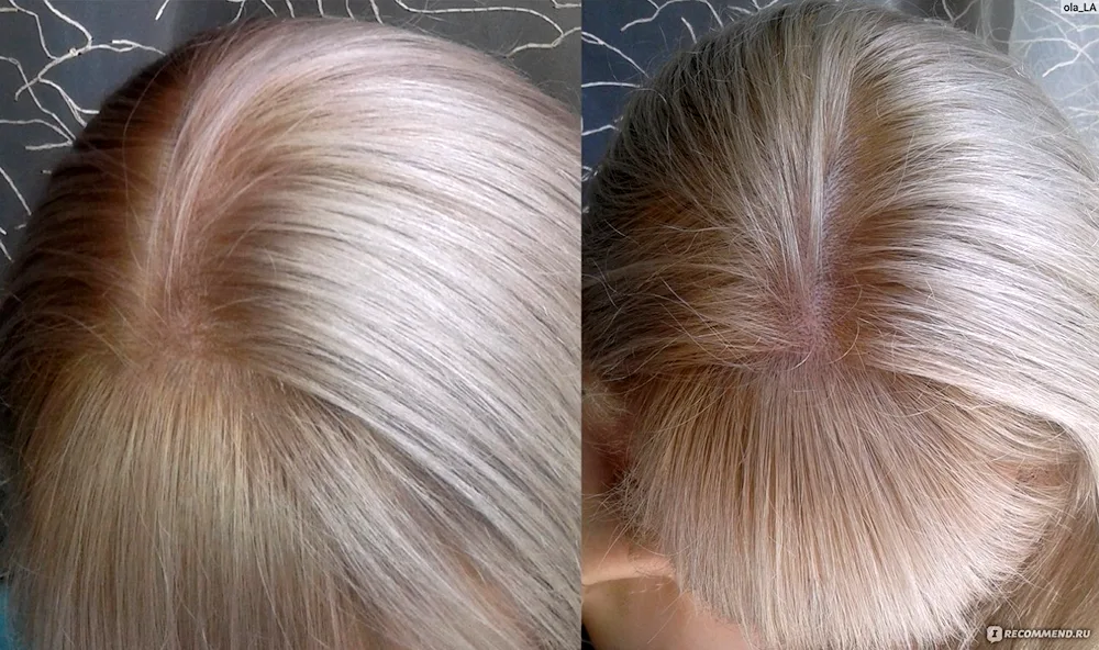 Estel toning 10.65 10. 1