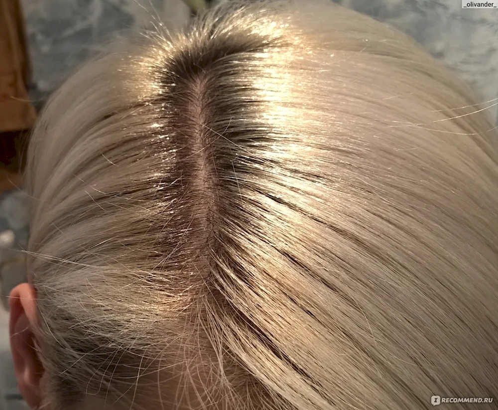 Hair lightening backgrounds