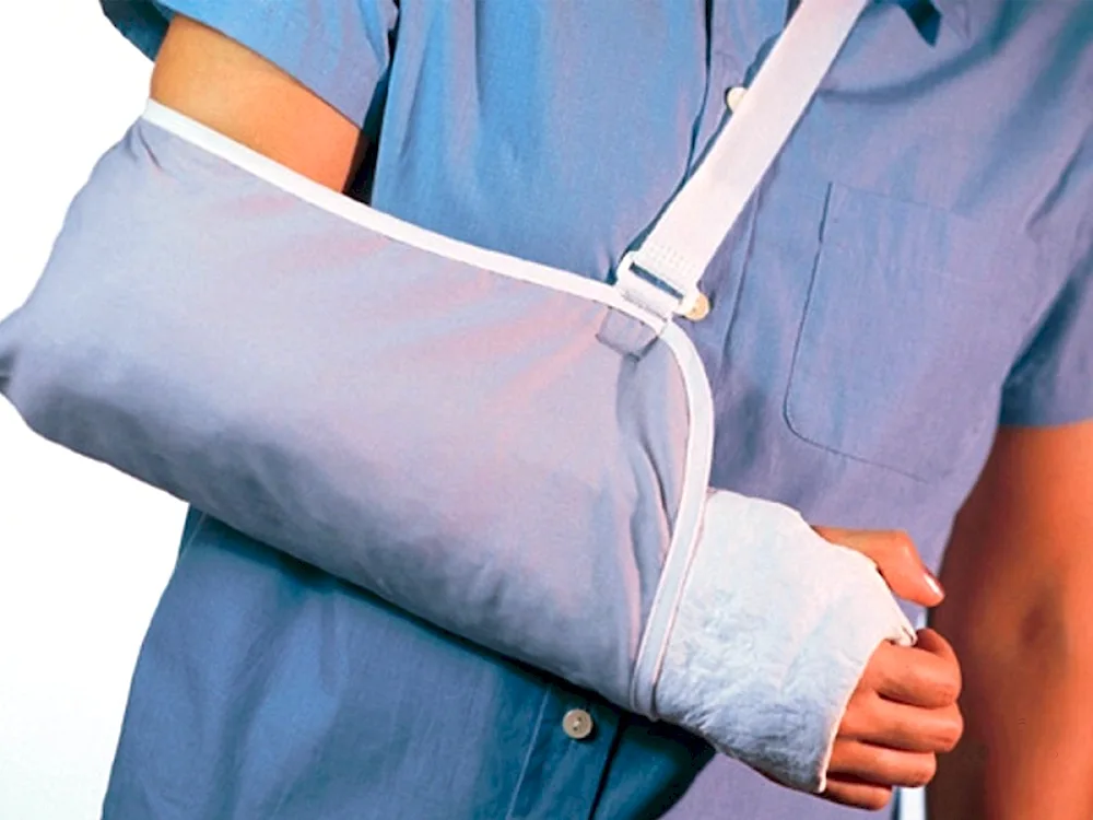 Gypsum bandage on the arm with a fracture