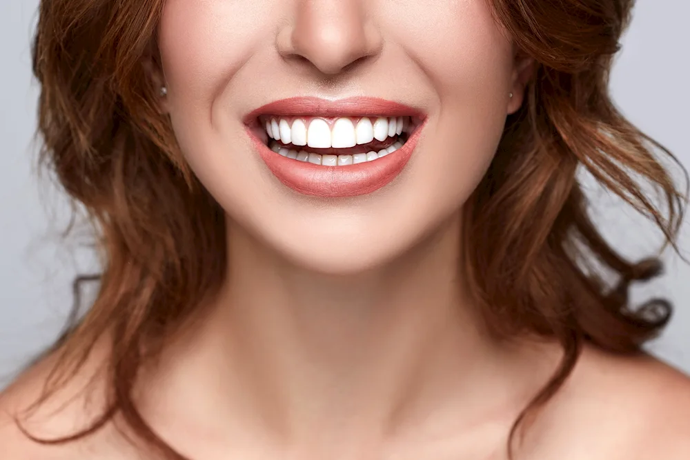 Hollywood smile veneers