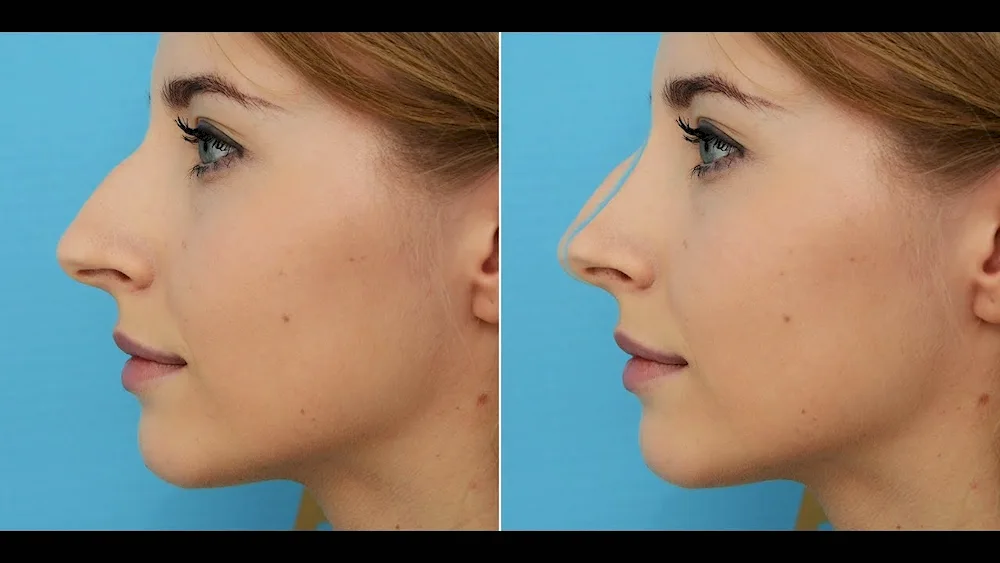 Gal Gadot humped nose