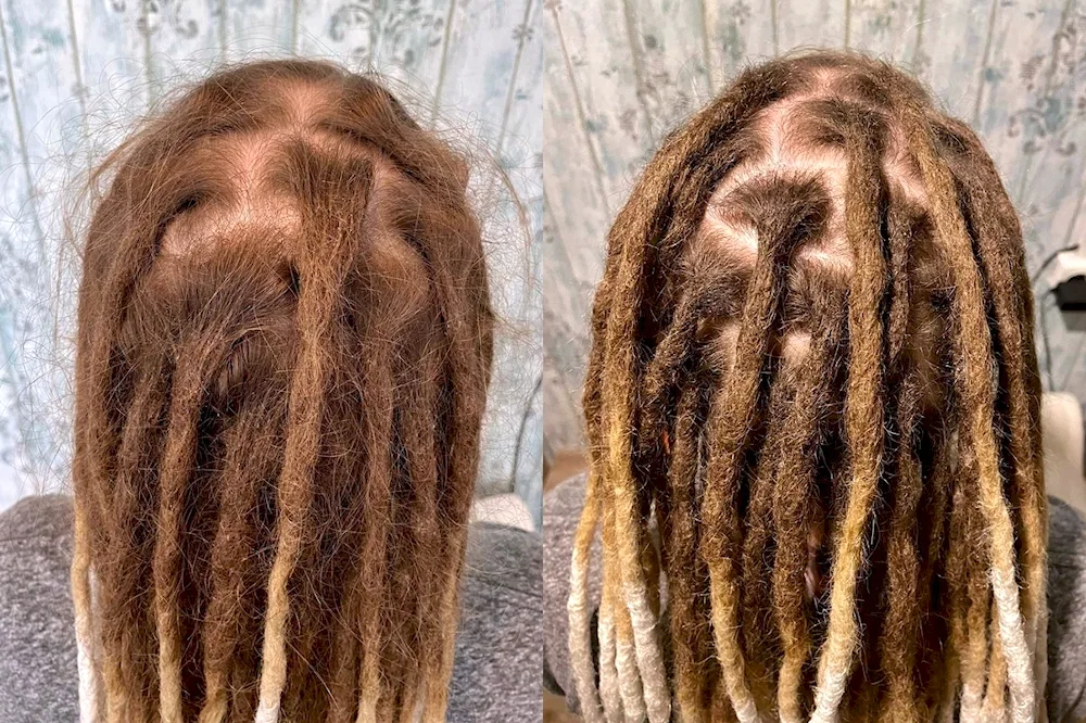 How dreadlocks look after braiding