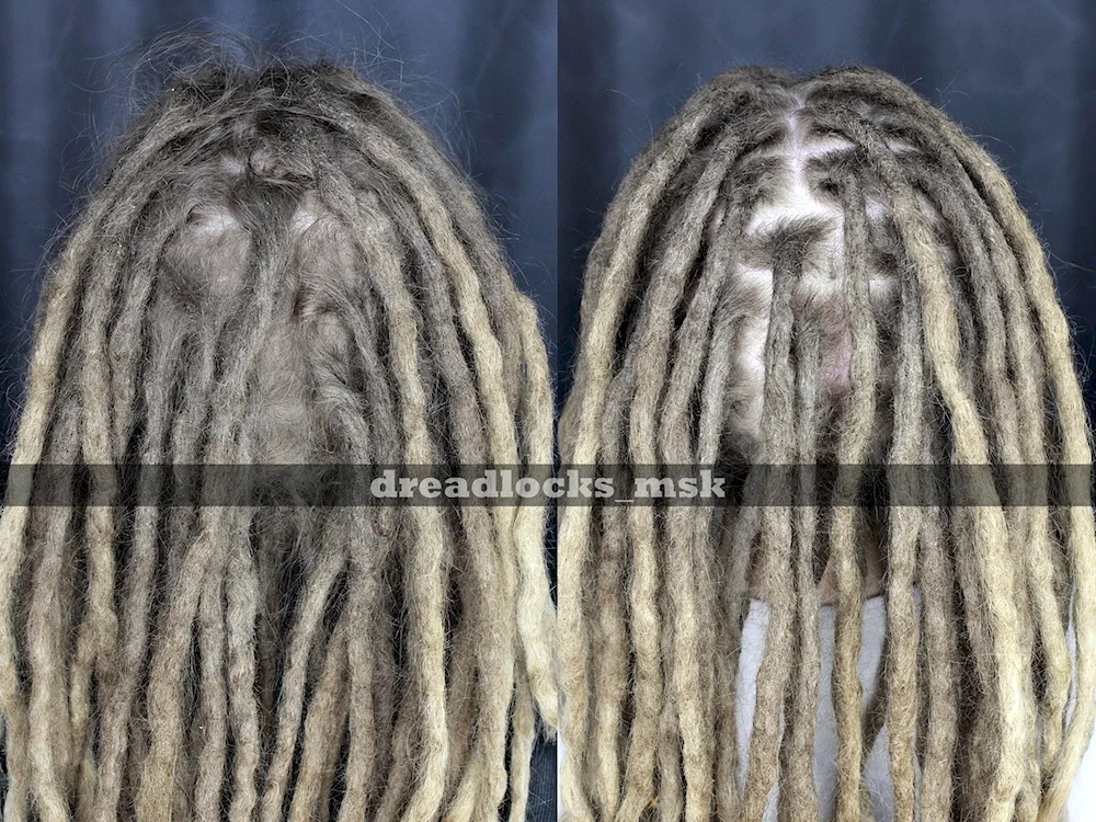 Morgenstern dreadlocks 2022