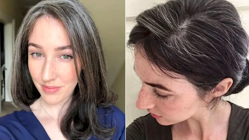 Grey hair