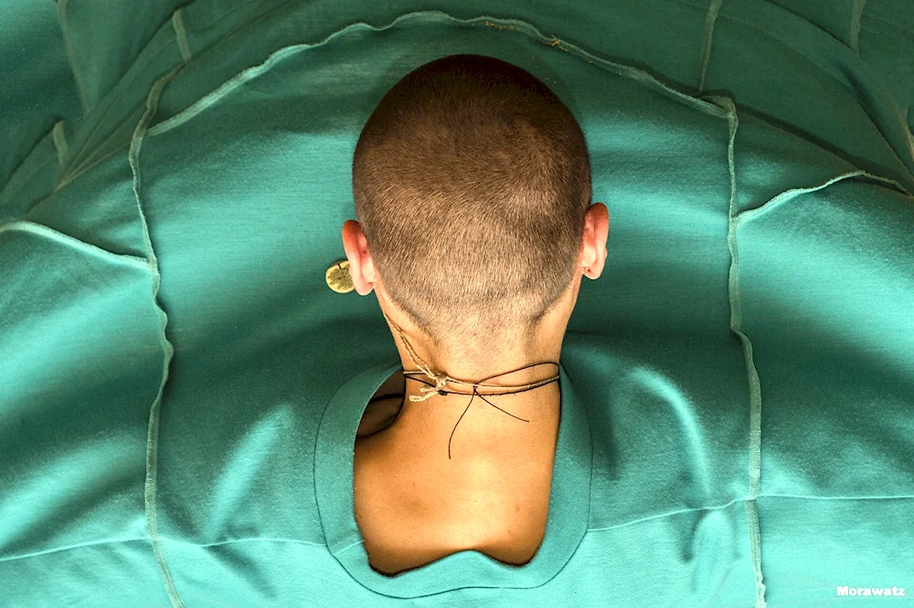 Fade semibox undercut