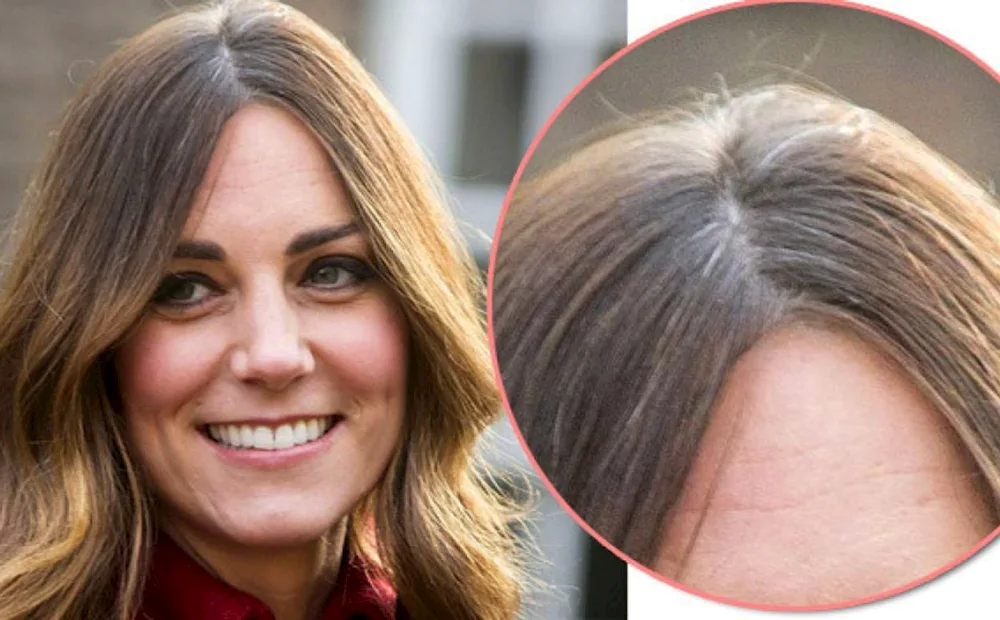 Kate Middleton grey hair