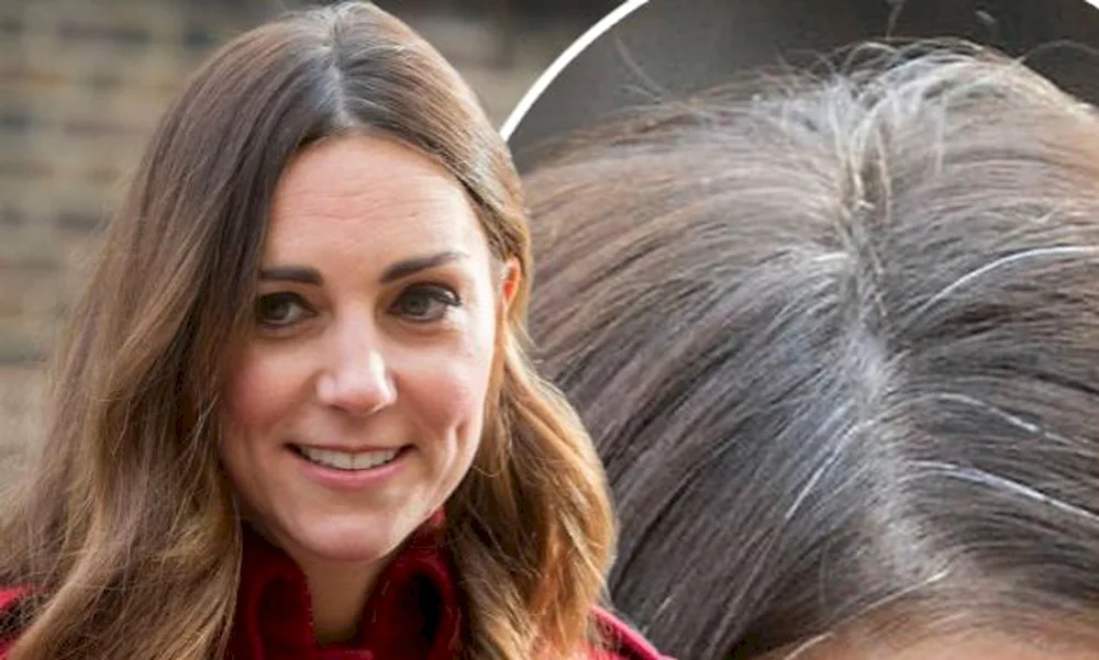 Kate Middleton Grey hair
