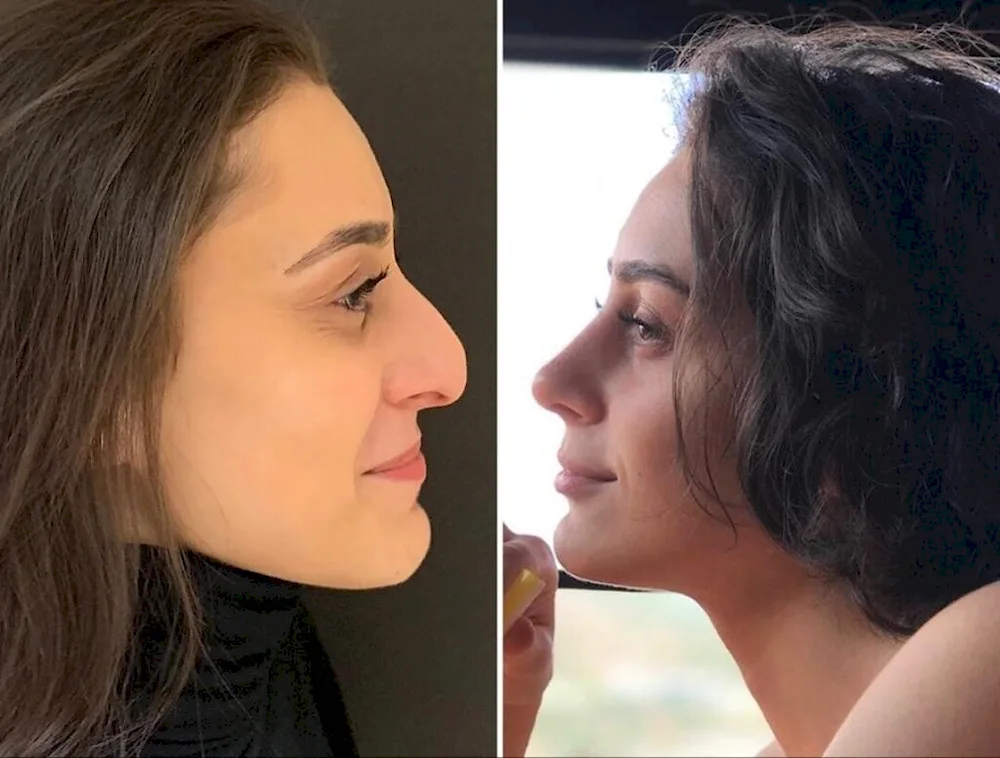 Carlette Johansson in profile