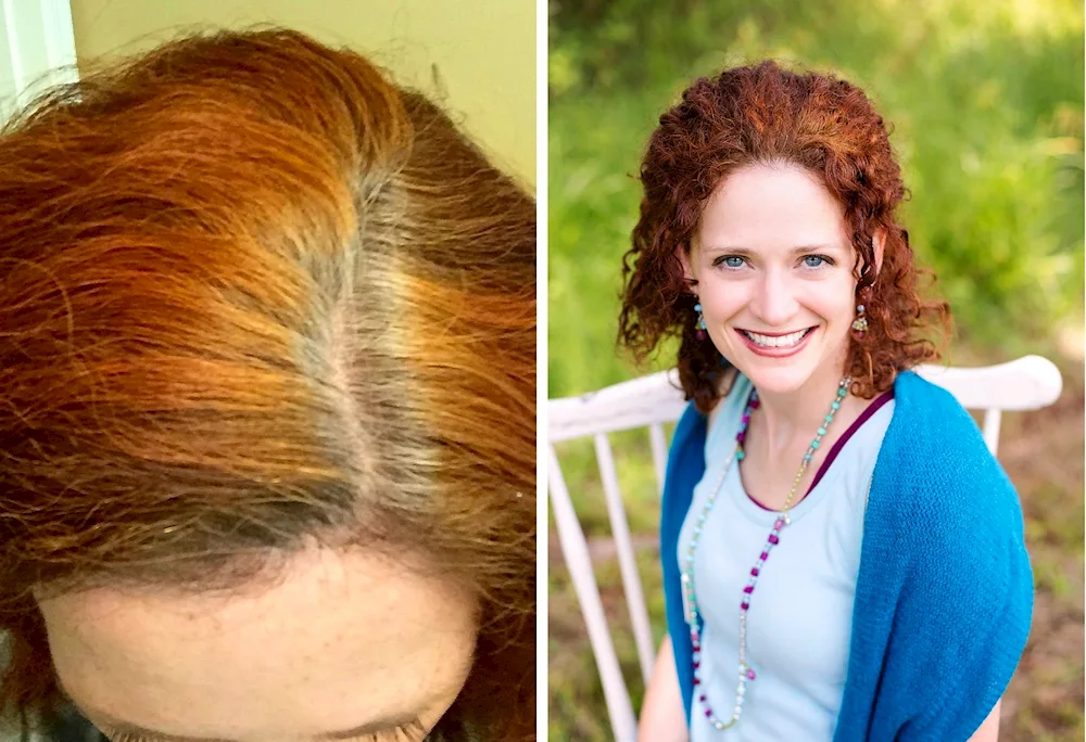 Hnna hair dyeing with henna