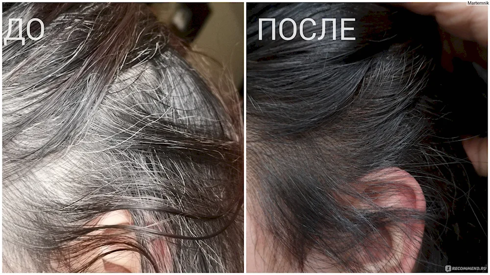 Woman dyeing hair