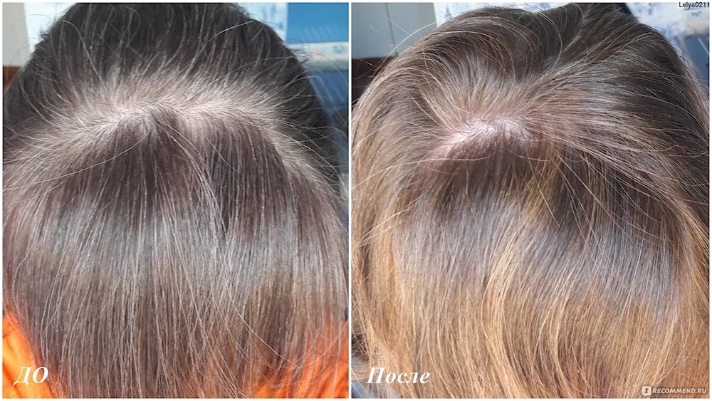 Hnna dyes grey hair