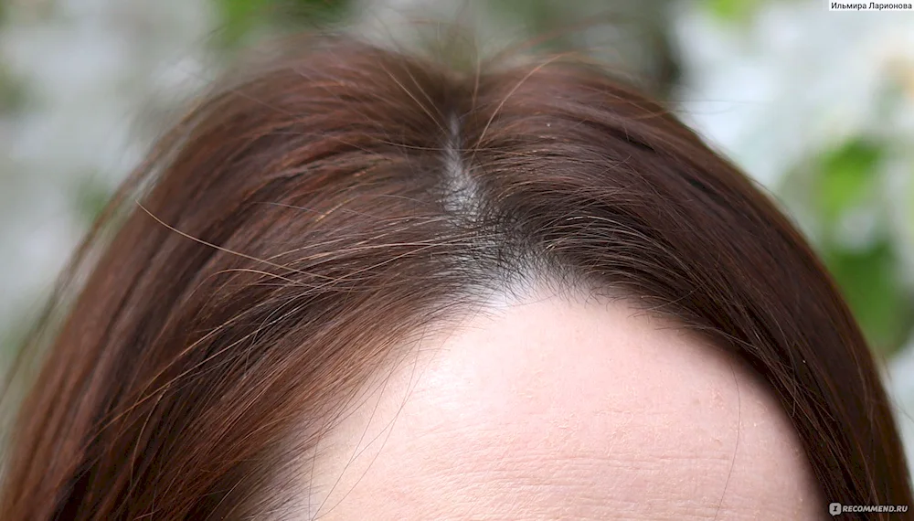 Hnna dyes grey hair. grey hair henna henna dyeing henna dyeing grey hair henna dyeing henna dyeing grey hair henna dyeing henna dyeing henna dyeing henna dyeing henna dyeing henna dyeing henna dyeing henna dyeing henna dyeing henna dyeing henna dyeing henna dyeing grey hair for grey hair