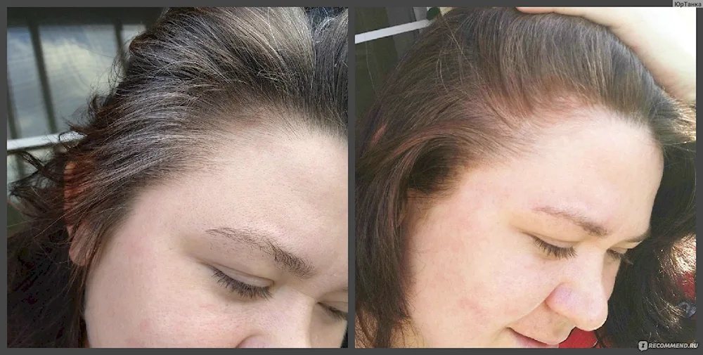 Hyna and basma to cover grey hair