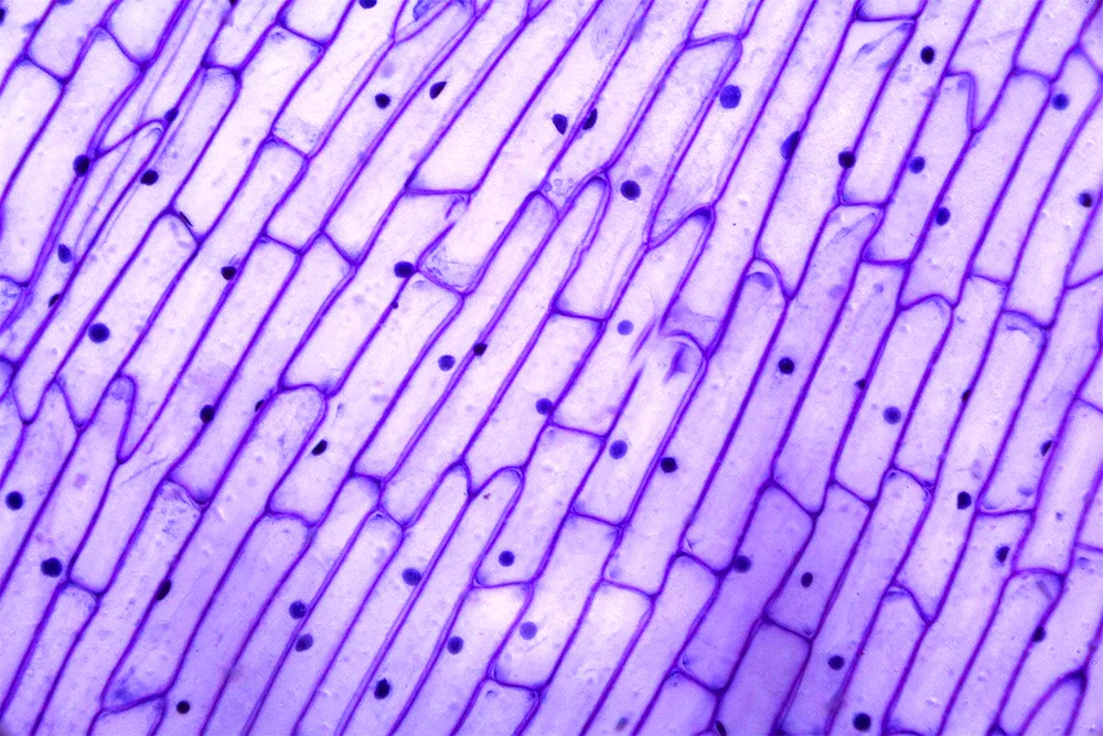 Onion skin cells in a microscope