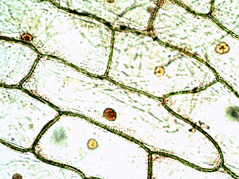 Onion peel cells under a microscope